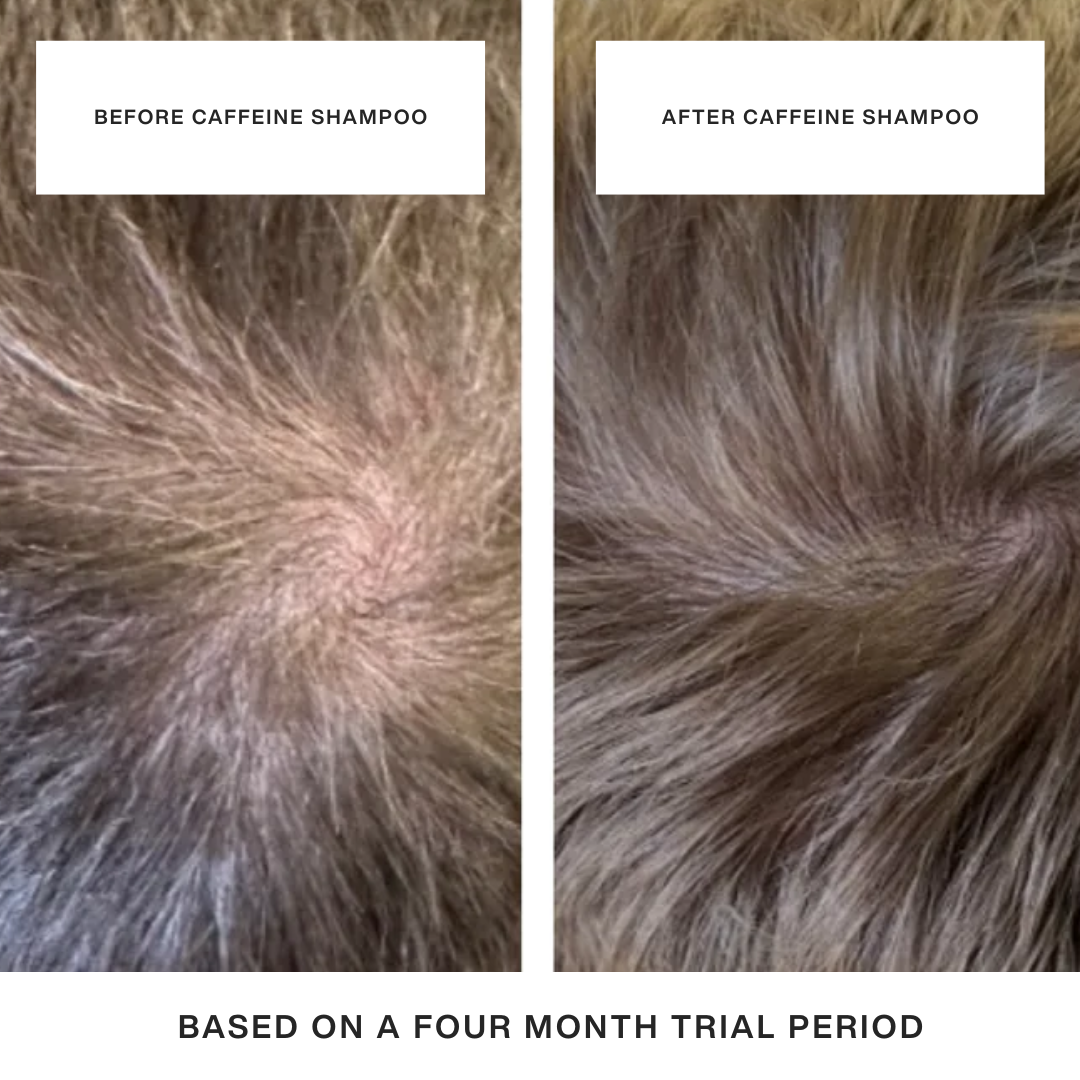 Caffeine Hair Bundle